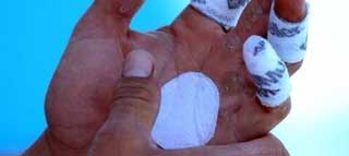 Rafa Nadal acelera la cicatrizaci�n con radiofrecuencia