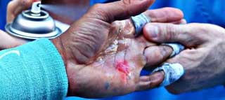 Al fisioterapeuta ya no se viene a sufrir