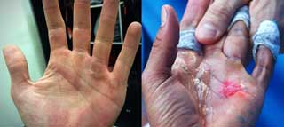 Las manos de Marc M�rquez, a lo Rafa Nadal